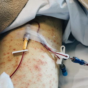 Leukemia at 29